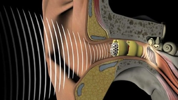 Kulak Rahatsızlıkları Belirtileri ve Tedavisi Kulak Rahatsızlıkları Belirtileri ve Tedavisi