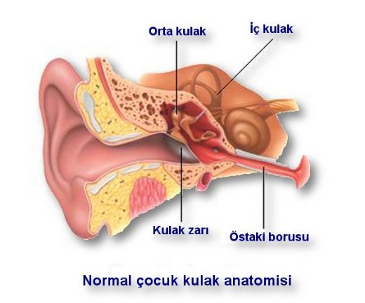 Kronik Orta Kulak ltihab