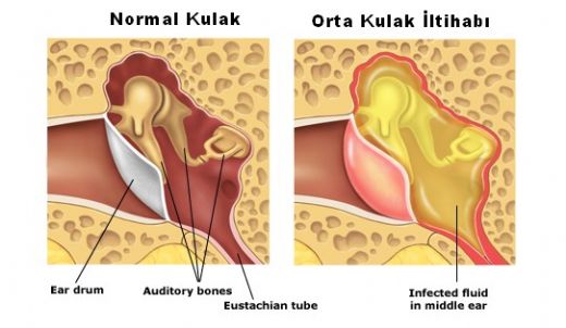 Kulak Svs